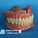 Dental-Arbeiten von RAB Zahntechnik Dentallabor Berlin Dental-Arbeiten von RAB Zahntechnik Dentallabor Berlin